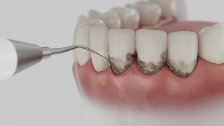 Reliable Dental Implants contractor in Ladoga, IN by Smile Center Dentistry